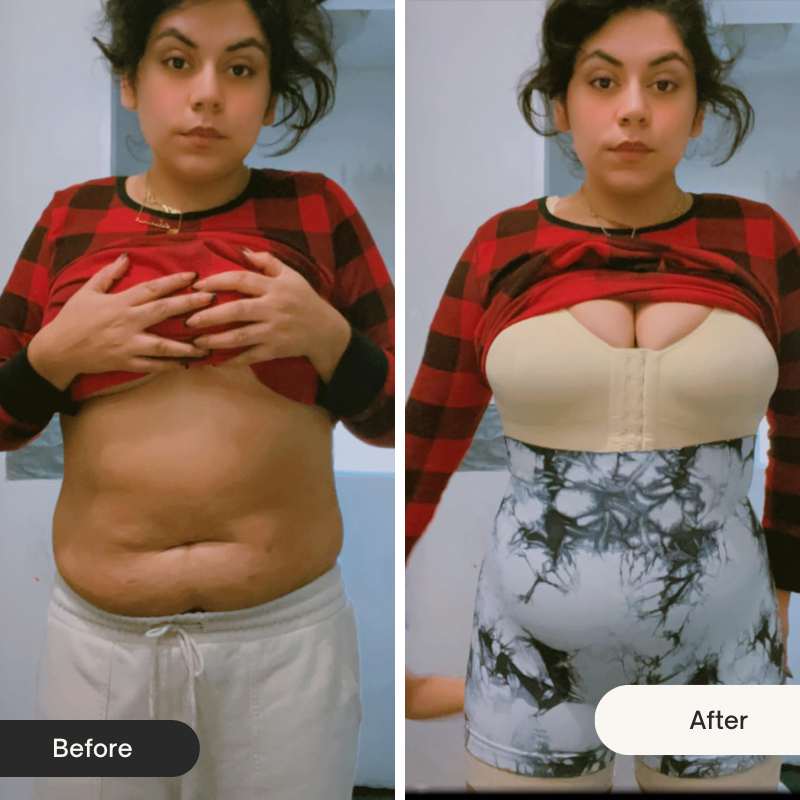 Korrazo Fajas Colombianas Tummy Control