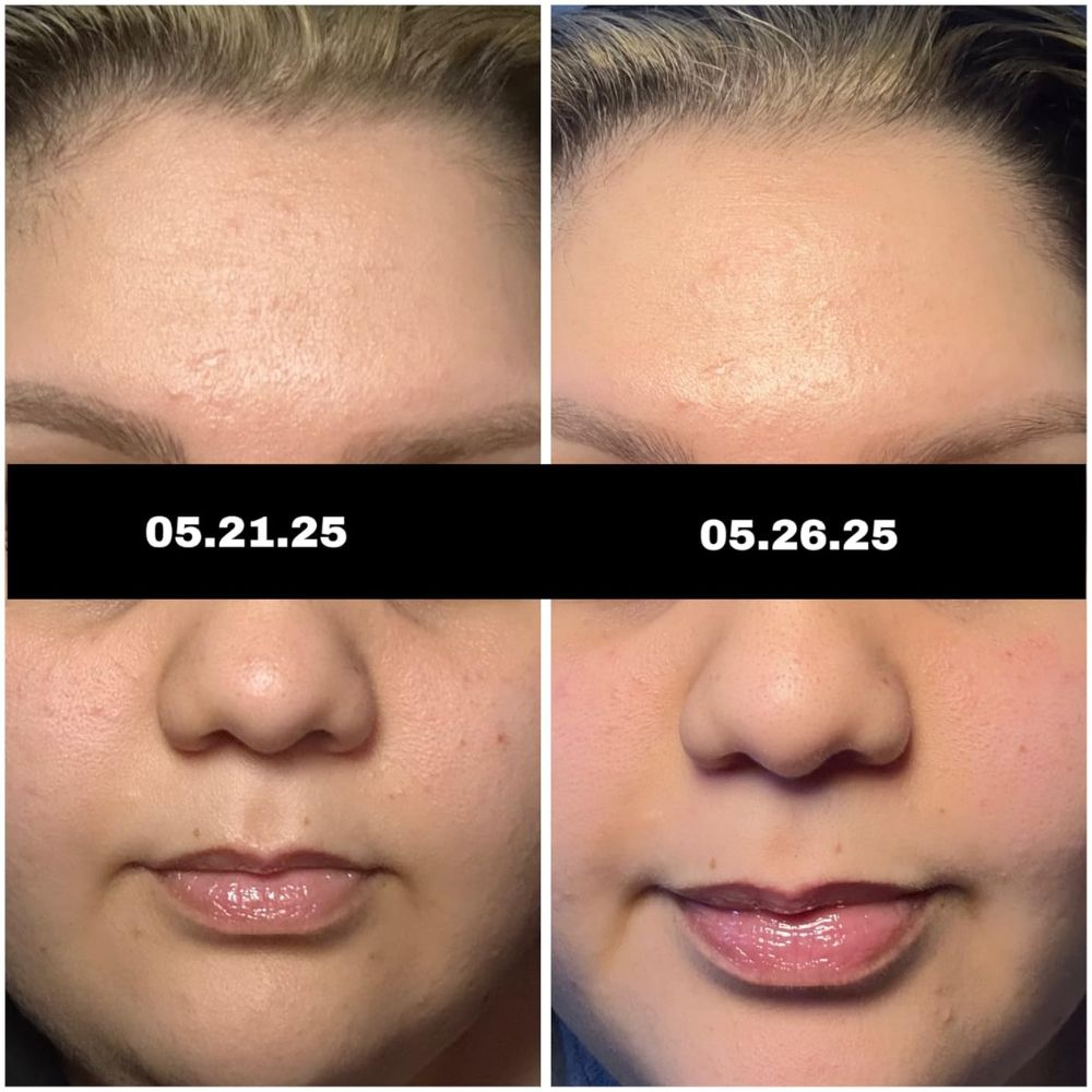 Glow-Boosting Korean Toner Pads