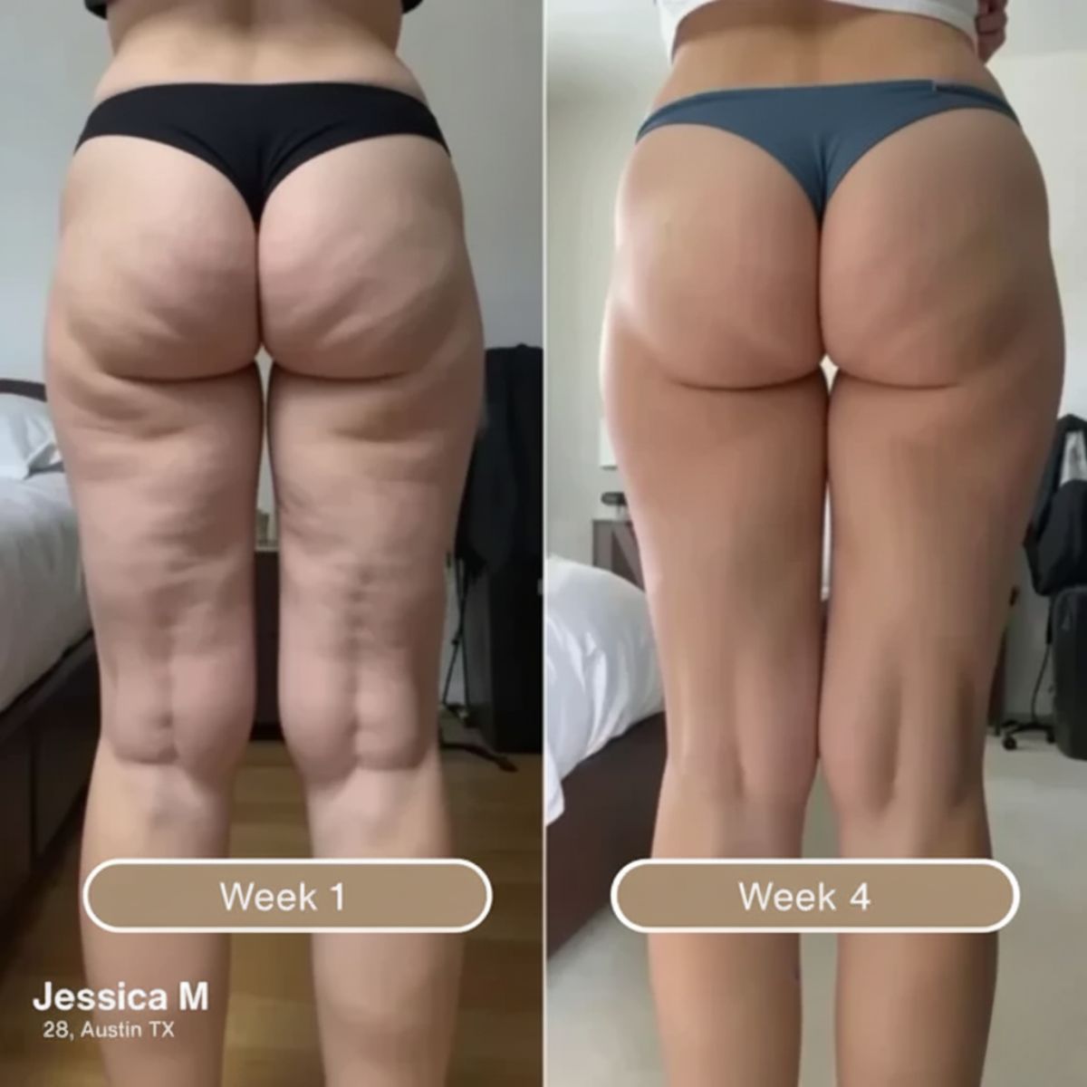 Korrazo Anti Cellulite Massage Oil