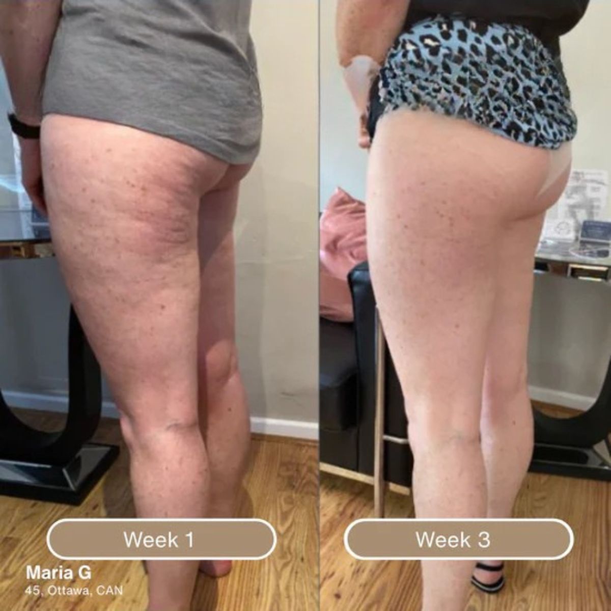 Korrazo Anti Cellulite Massage Oil