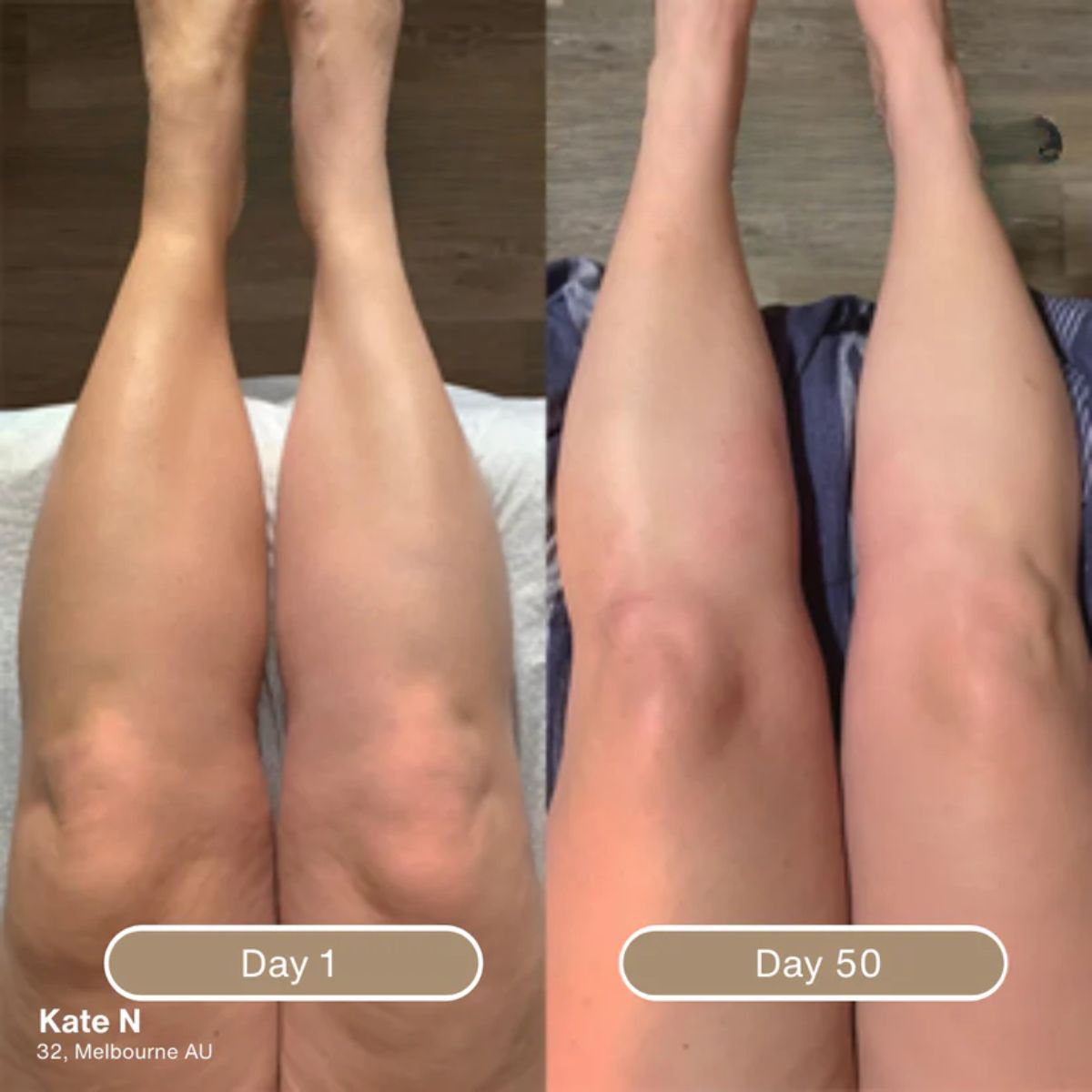 Korrazo Anti Cellulite Massage Oil